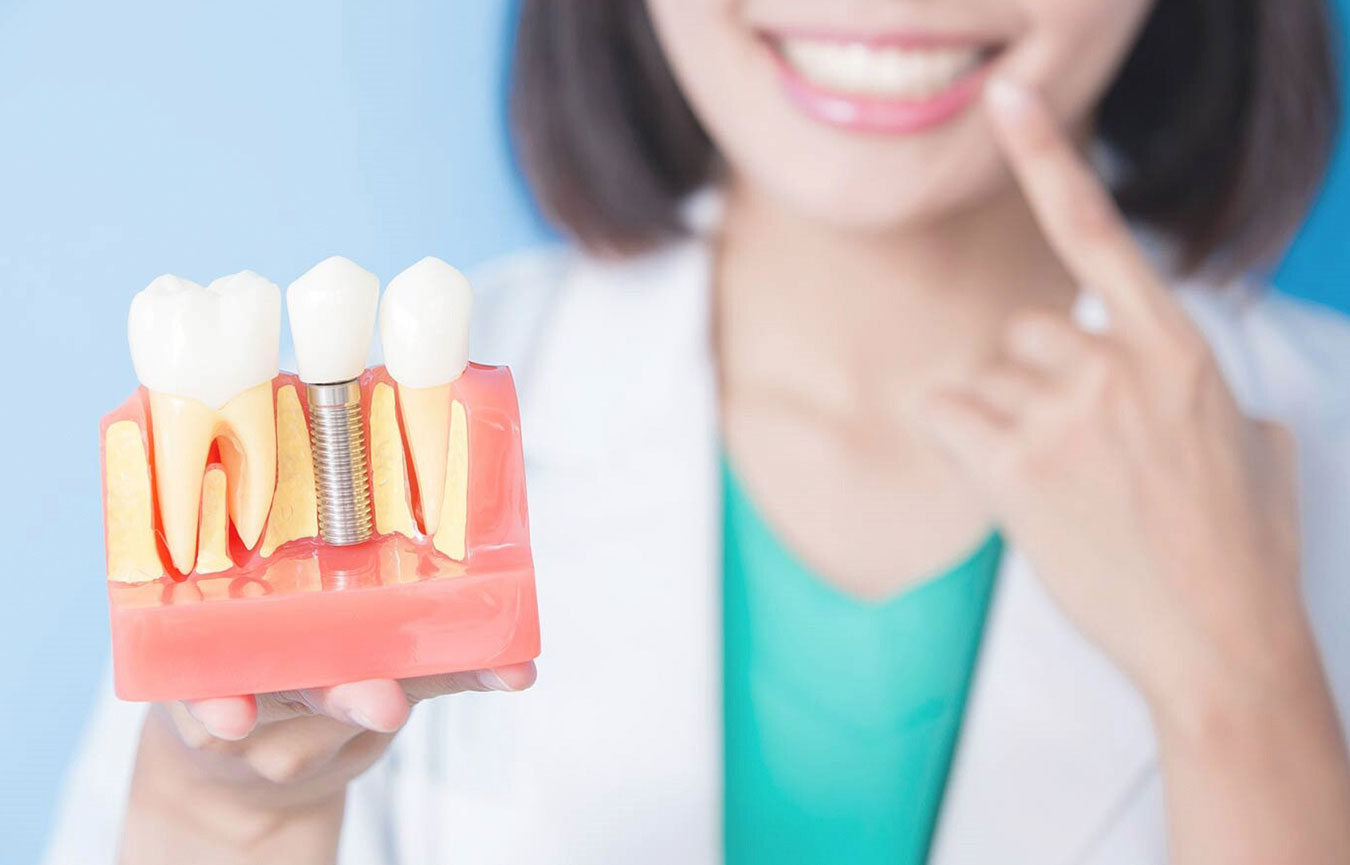 Dental Implant in Chembur