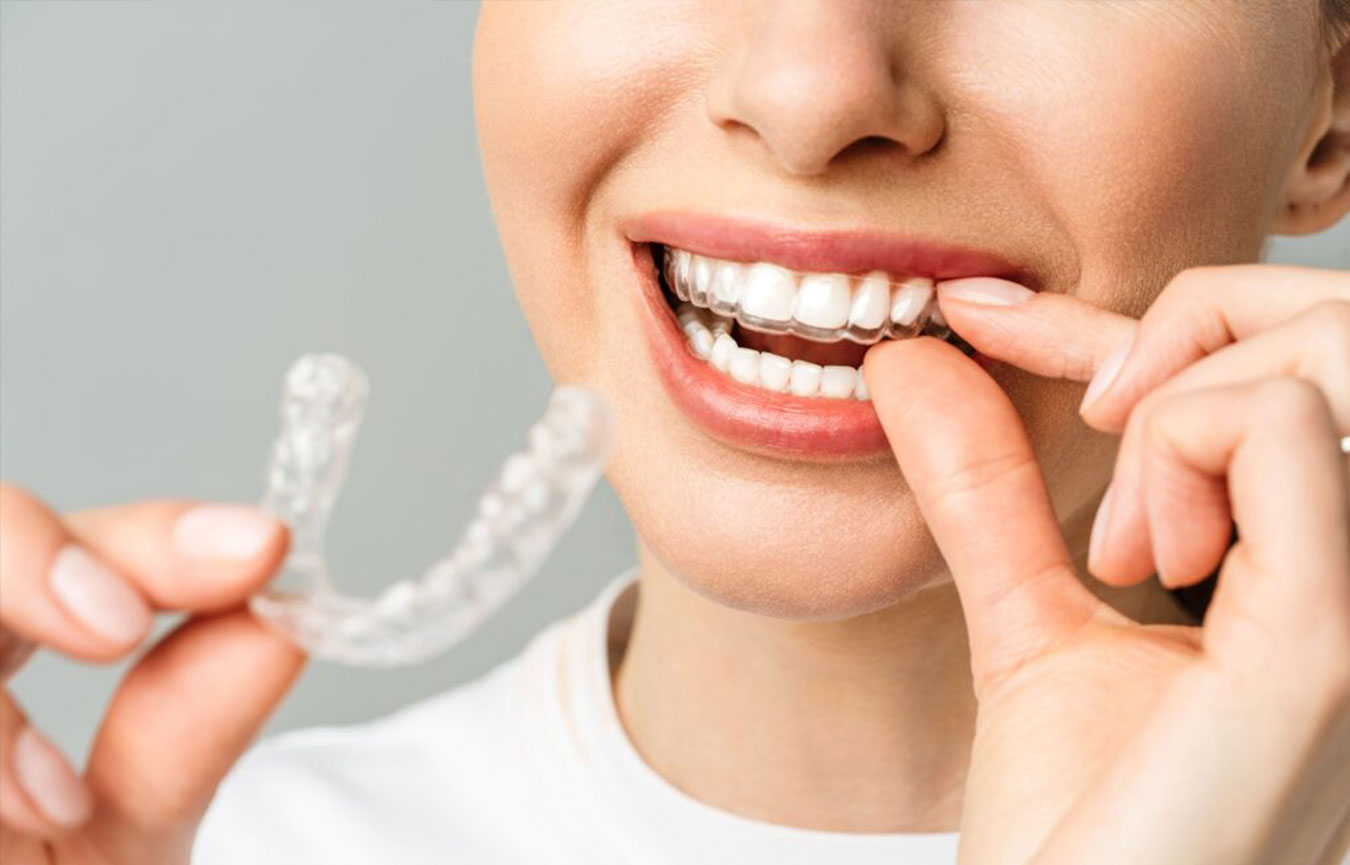 Invisalign Treatment in Chembur