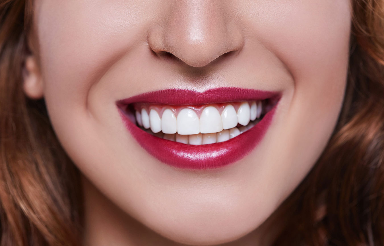 Smile Makeover in Chembur