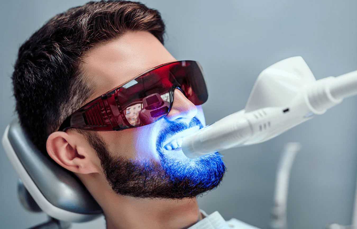 Teeth Whitening in Chembur