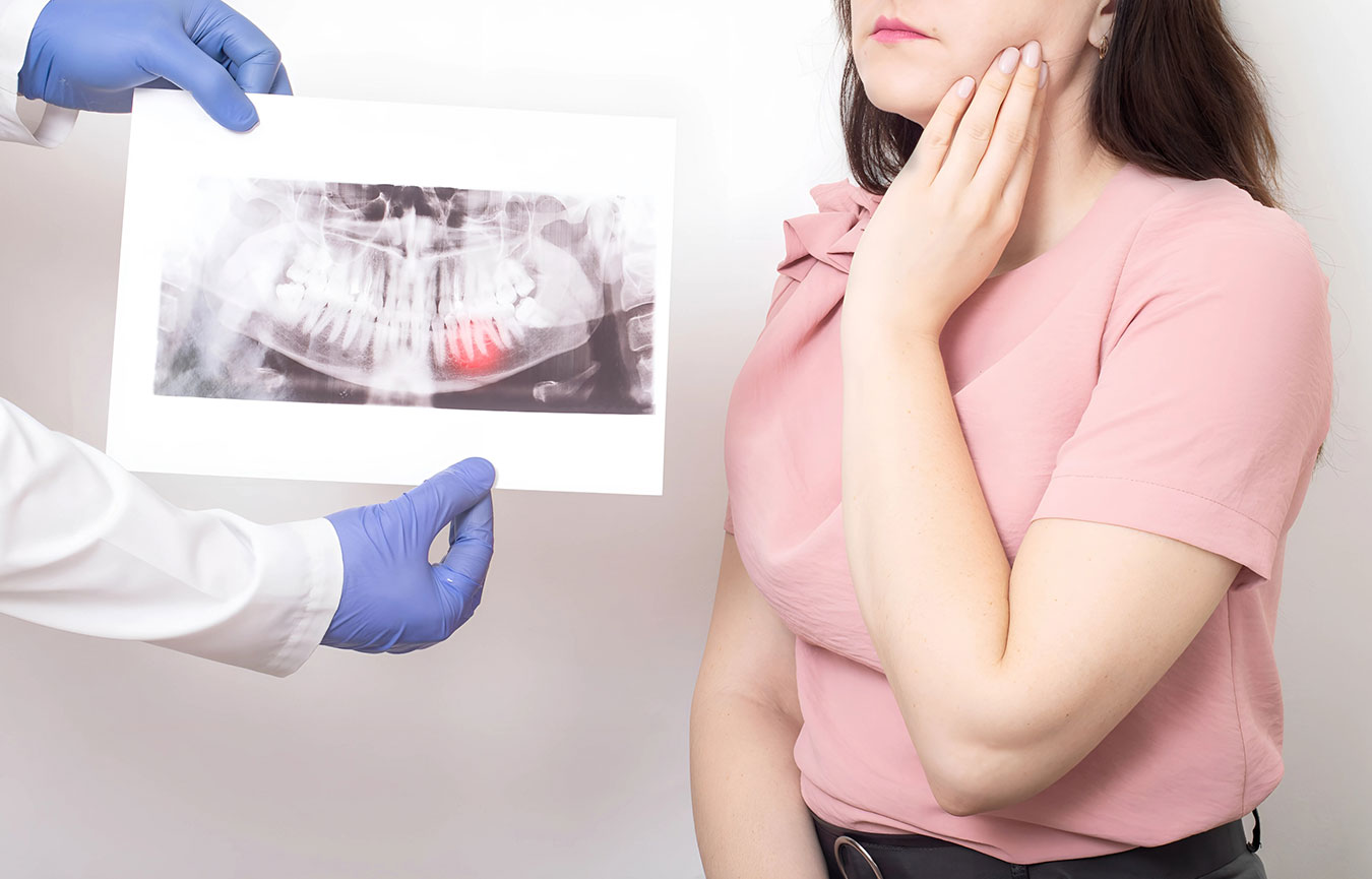 Wisdom Tooth Removal in Chembur